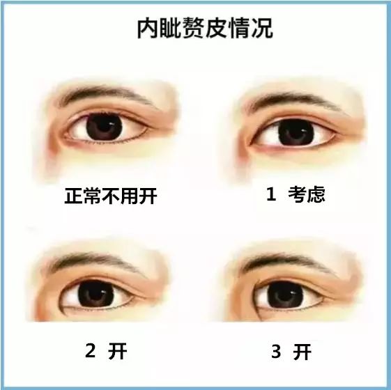双眼皮术后后遗症，了解可能的风险与预防措施