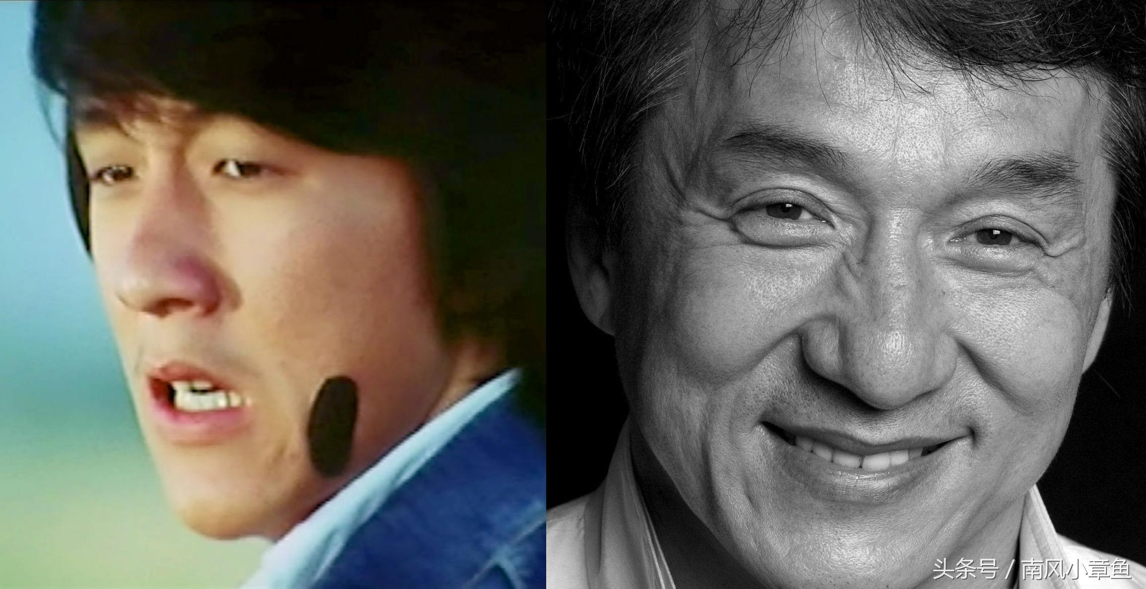双眼皮手术，对眼睛影响的深度解析