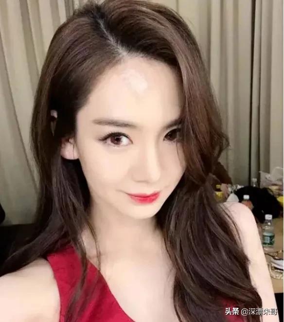 双眼皮手术后的常见后遗症及其预防措施
