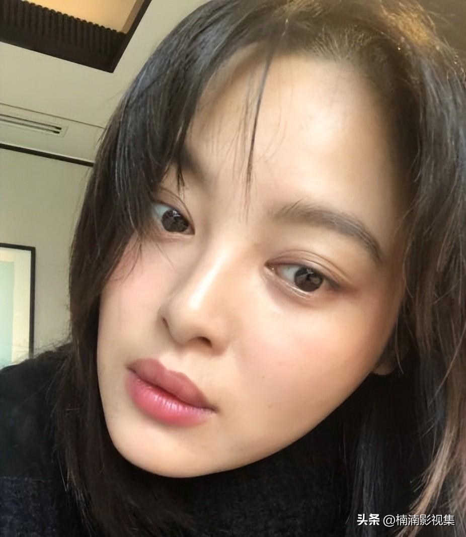 双眼皮手术，后遗症与风险全解析